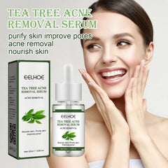 EELHOE Tea Tree Acne Repair Essence To Remove Acne, Nourish The Skin