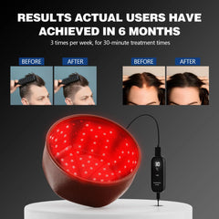 Hair Growth Cap  for Hair Loss 120LEDs 660nm&850nm Reduces Oiliness Deep Into Hair Follicles Strengthen Hair Roots Hair Care Hat
